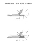 Bifurcated Stent and Delivery System diagram and image