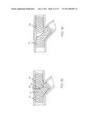 Bifurcated Stent and Delivery System diagram and image