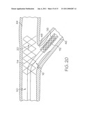 Bifurcated Stent and Delivery System diagram and image