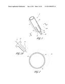 OSTIUM SUPPORT FOR TREATING VASCULAR BIFURCATIONS diagram and image