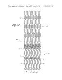 OSTIUM SUPPORT FOR TREATING VASCULAR BIFURCATIONS diagram and image