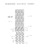 OSTIUM SUPPORT FOR TREATING VASCULAR BIFURCATIONS diagram and image