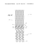 OSTIUM SUPPORT FOR TREATING VASCULAR BIFURCATIONS diagram and image