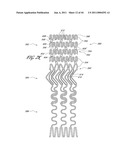 OSTIUM SUPPORT FOR TREATING VASCULAR BIFURCATIONS diagram and image