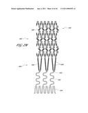 OSTIUM SUPPORT FOR TREATING VASCULAR BIFURCATIONS diagram and image