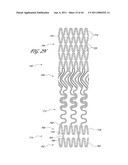 OSTIUM SUPPORT FOR TREATING VASCULAR BIFURCATIONS diagram and image