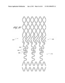 OSTIUM SUPPORT FOR TREATING VASCULAR BIFURCATIONS diagram and image