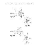 OSTIUM SUPPORT FOR TREATING VASCULAR BIFURCATIONS diagram and image