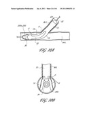 OSTIUM SUPPORT FOR TREATING VASCULAR BIFURCATIONS diagram and image