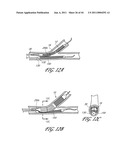 OSTIUM SUPPORT FOR TREATING VASCULAR BIFURCATIONS diagram and image