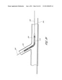 OSTIUM SUPPORT FOR TREATING VASCULAR BIFURCATIONS diagram and image