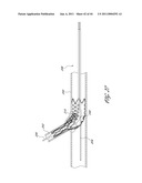 OSTIUM SUPPORT FOR TREATING VASCULAR BIFURCATIONS diagram and image