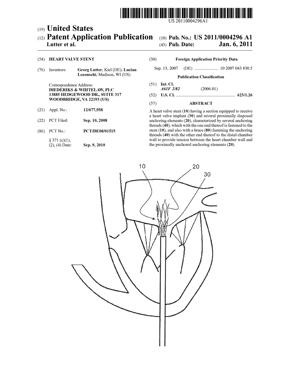 Heart Valve Stent - diagram, schematic, and image 01