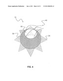 Heart Valve Stent diagram and image