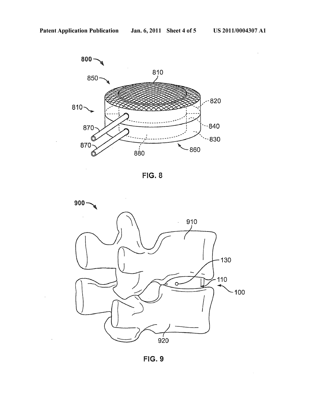 FUSION DEVICE, SYSTEMS AND METHODS THEREOF - diagram, schematic, and image 05