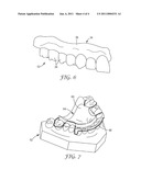 METHODS OF PREPARING A VIRTUAL DENTITION MODEL AND FABRICATING A DENTAL RETAINER THEREFROM diagram and image