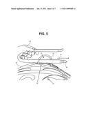 ARTICLE FOR LOCKING AN ACCESSORY TO A PHYSICAL STRUCTURE USING A SEPARATE LOCKING DEVICE AND THE COMBINATION THEREOF diagram and image