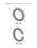 Device and Method for Braiding Fibers into a Braided Structure diagram and image