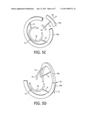 Device and Method for Braiding Fibers into a Braided Structure diagram and image