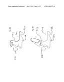 Charging handle diagram and image