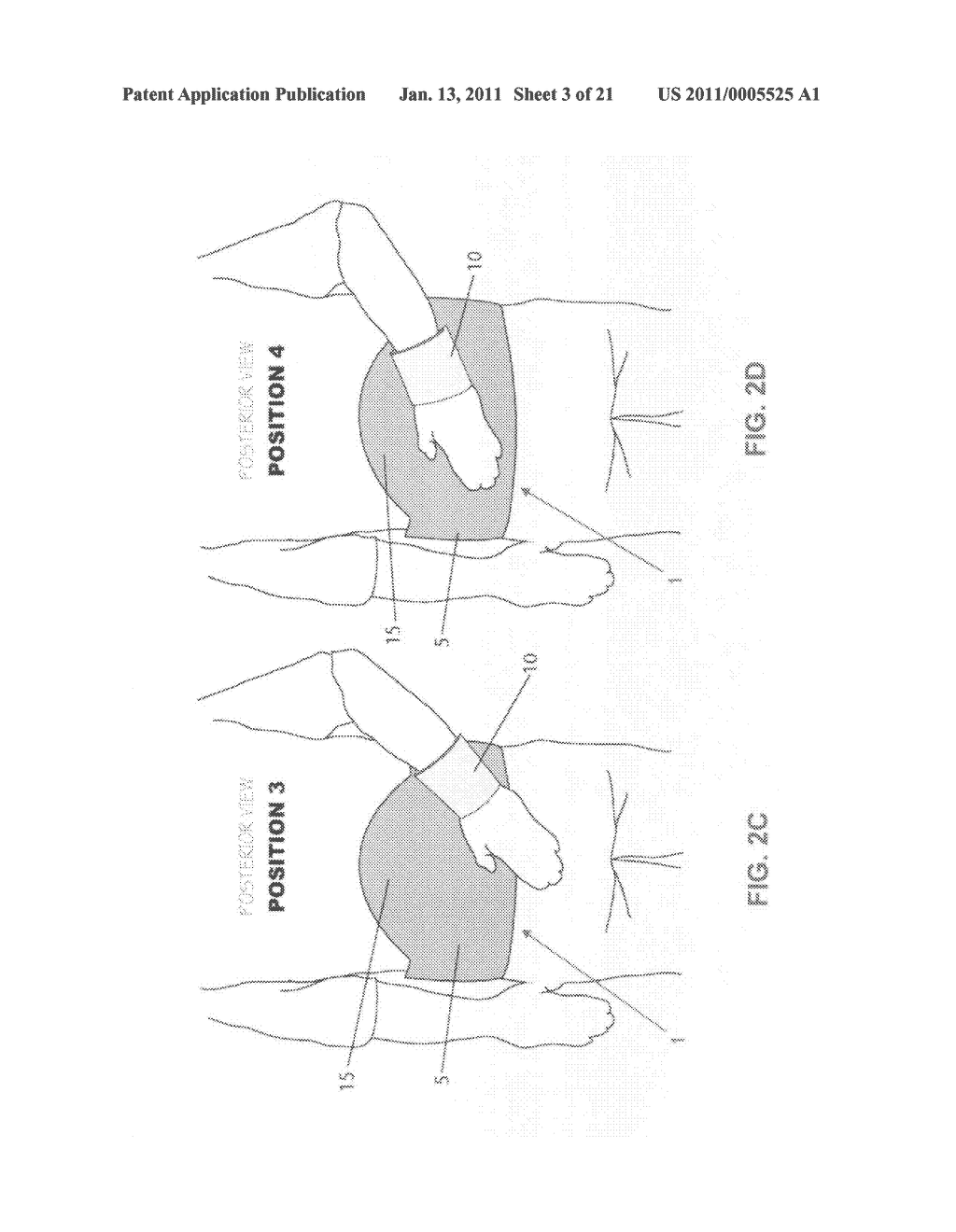 METHOD AND APPARATUS FOR THERAPEUTICALLY SUPPORTING THE ARM OF A PATIENT - diagram, schematic, and image 04