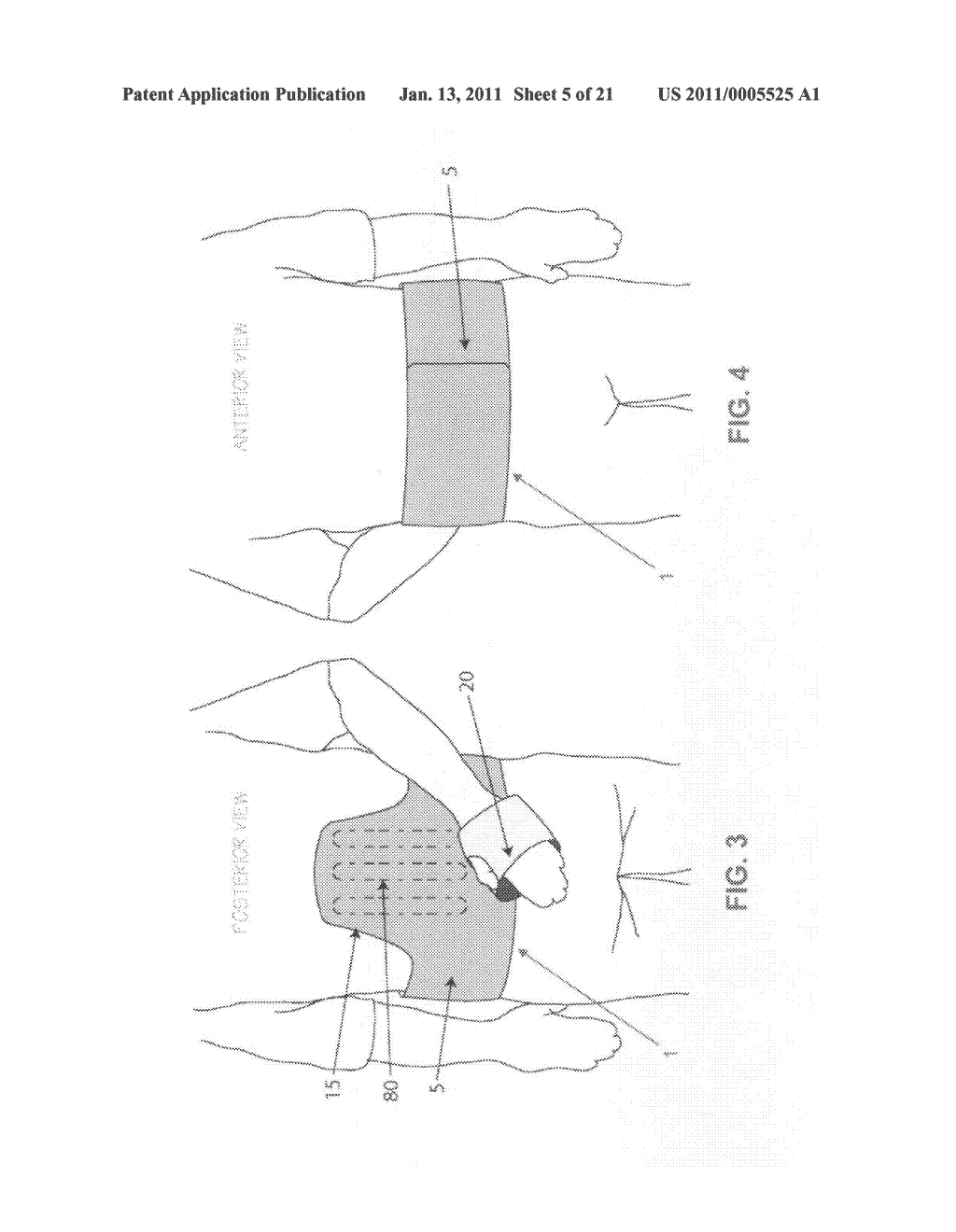 METHOD AND APPARATUS FOR THERAPEUTICALLY SUPPORTING THE ARM OF A PATIENT - diagram, schematic, and image 06