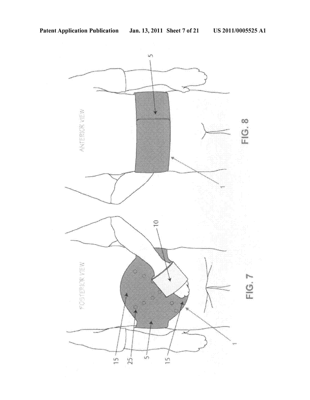 METHOD AND APPARATUS FOR THERAPEUTICALLY SUPPORTING THE ARM OF A PATIENT - diagram, schematic, and image 08