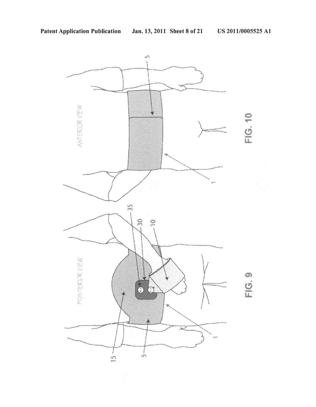 METHOD AND APPARATUS FOR THERAPEUTICALLY SUPPORTING THE ARM OF A PATIENT - diagram, schematic, and image 09