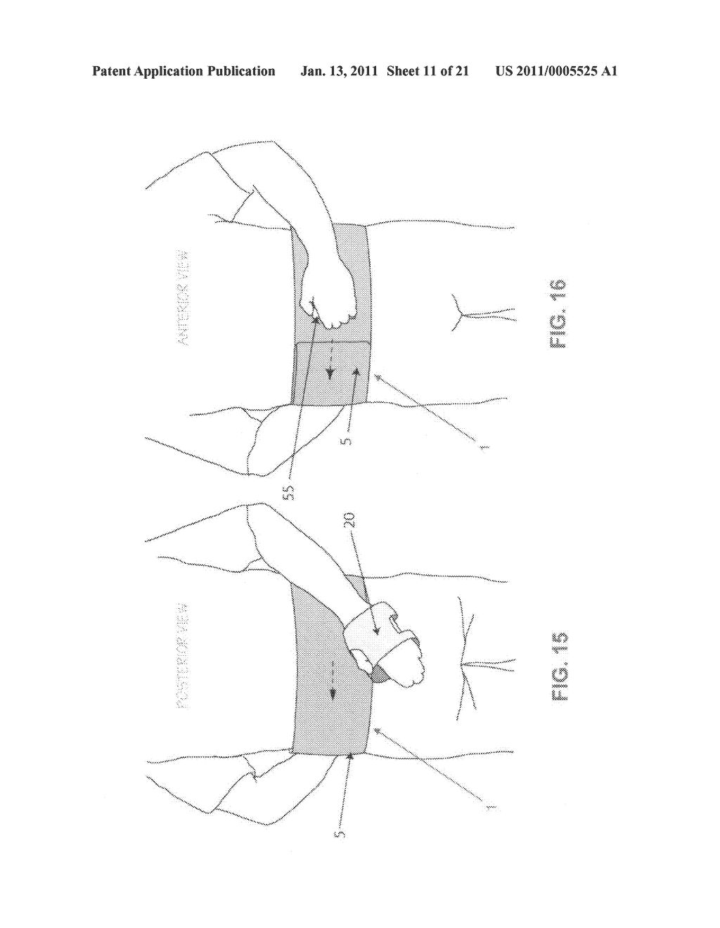 METHOD AND APPARATUS FOR THERAPEUTICALLY SUPPORTING THE ARM OF A PATIENT - diagram, schematic, and image 12