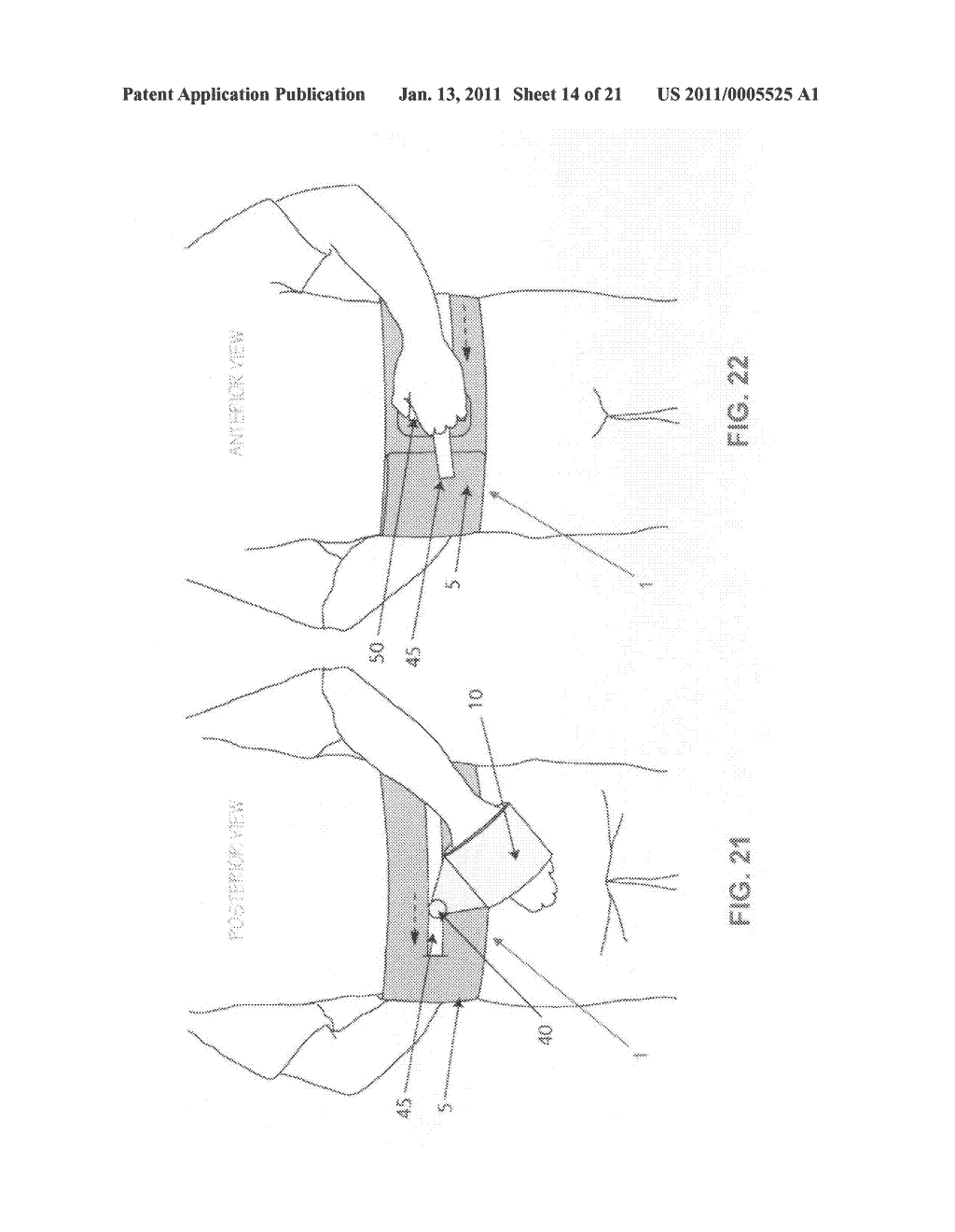 METHOD AND APPARATUS FOR THERAPEUTICALLY SUPPORTING THE ARM OF A PATIENT - diagram, schematic, and image 15
