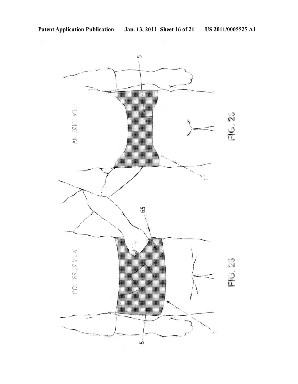 METHOD AND APPARATUS FOR THERAPEUTICALLY SUPPORTING THE ARM OF A PATIENT - diagram, schematic, and image 17