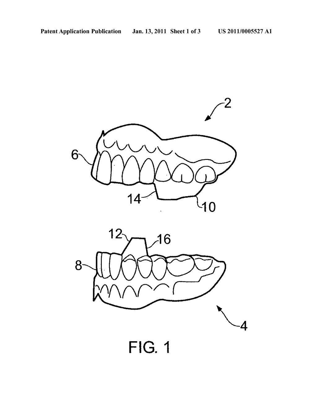 ORTHODONTIC APPLIANCES - diagram, schematic, and image 02