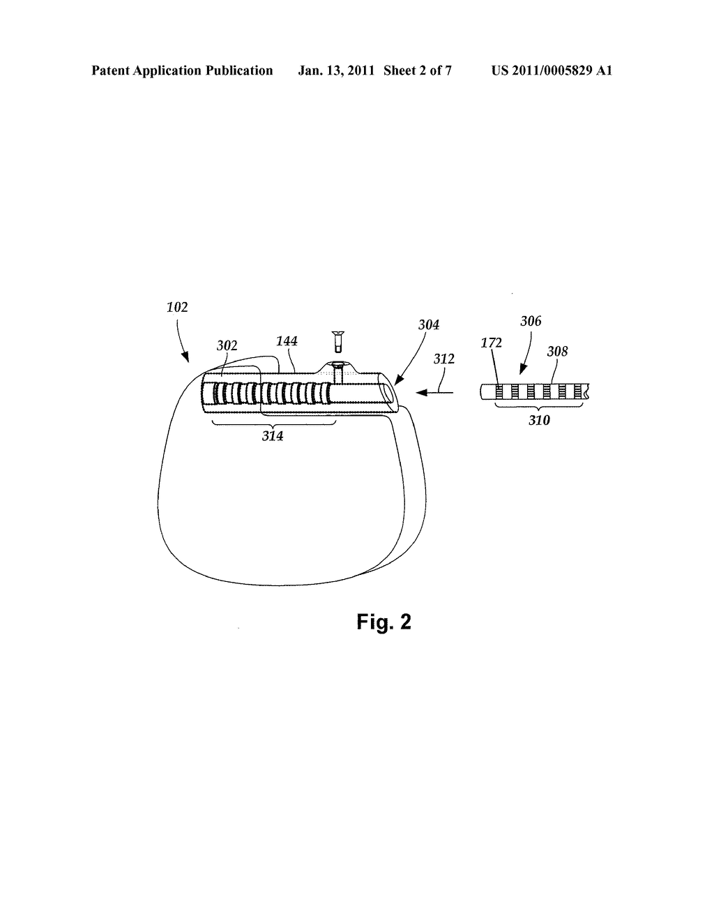 METHOD FOR FABRICATING A NEUROSTIMULATION LEAD CONTACT ARRAY - diagram, schematic, and image 03