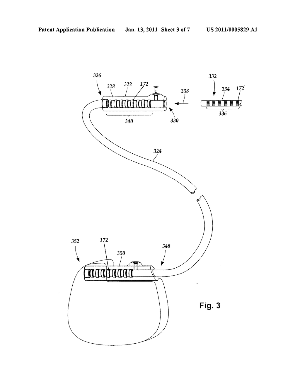 METHOD FOR FABRICATING A NEUROSTIMULATION LEAD CONTACT ARRAY - diagram, schematic, and image 04
