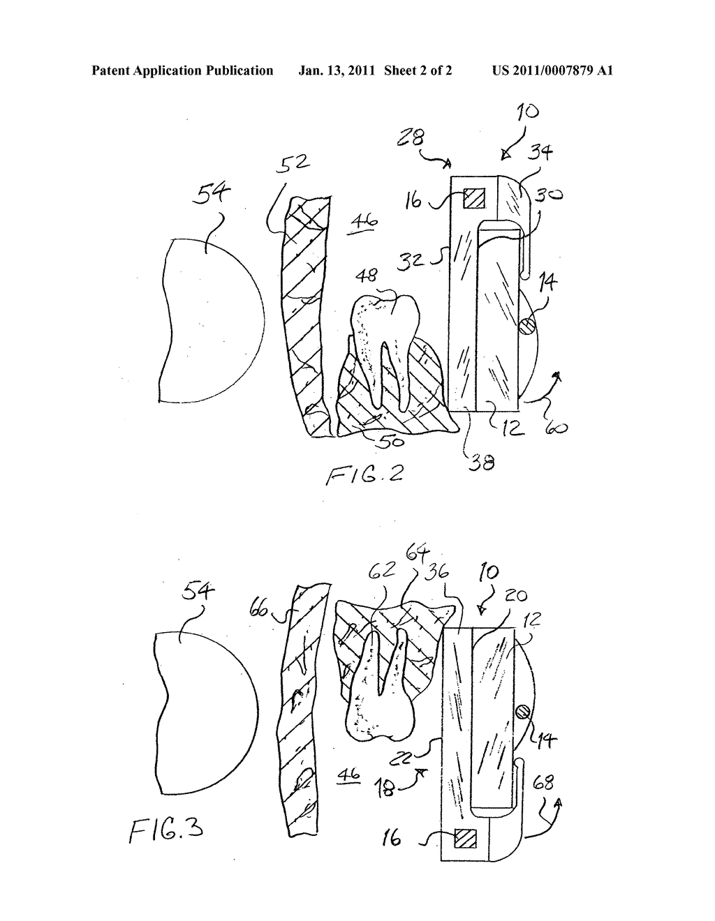 Dental radiograph sensor positioning device - diagram, schematic, and image 03