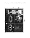 Method and System for Database-Guided Lesion Detection and Assessment diagram and image