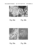 METHODS OF AND COMPOSITIONS FOR INHIBITING THE PROLIFERATION OF MAMMALIAN CELLS diagram and image