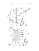 ENHANCEMENT OF LIGHT ACTIVATED DRUG THERAPY THROUGH COMBINATION WITH OTHER THERAPEUTIC AGENTS diagram and image