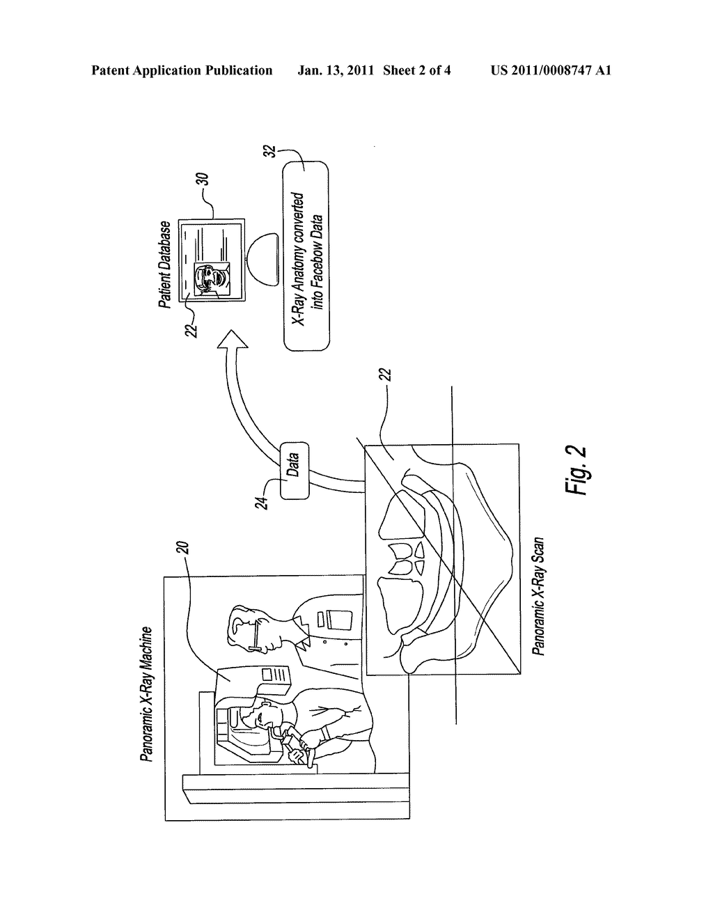 Method and Apparatus for Electronically Modeling and Manufacturing Dentures - diagram, schematic, and image 03