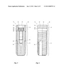 TOOTH IMPLANT AND METHOD FOR PRODUCTION THEREOF diagram and image