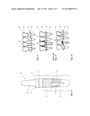 TOOTH IMPLANT AND METHOD FOR PRODUCTION THEREOF diagram and image