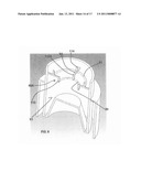 CORNEA STORAGE CONTAINER TO OPTIMIZE CORNEA HEALTH diagram and image