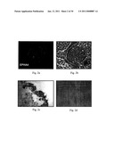 EPHA4-POSITIVE HUMAN ADULT PANCREATIC ENDOCRINE PROGENITOR CELLS diagram and image