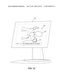 IMAGE GUIDED HIGH INTENSITY FOCUSED ULTRASOUND TREATMENT OF NERVES diagram and image