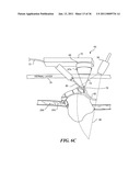 IMAGE GUIDED HIGH INTENSITY FOCUSED ULTRASOUND TREATMENT OF NERVES diagram and image