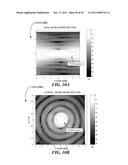 IMAGE GUIDED HIGH INTENSITY FOCUSED ULTRASOUND TREATMENT OF NERVES diagram and image