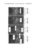 IMAGE GUIDED HIGH INTENSITY FOCUSED ULTRASOUND TREATMENT OF NERVES diagram and image