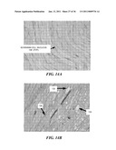 IMAGE GUIDED HIGH INTENSITY FOCUSED ULTRASOUND TREATMENT OF NERVES diagram and image