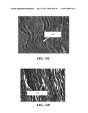 IMAGE GUIDED HIGH INTENSITY FOCUSED ULTRASOUND TREATMENT OF NERVES diagram and image