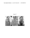 SYSTEM FOR DIAGNOSING MULTIPLE SCLEROSIS diagram and image